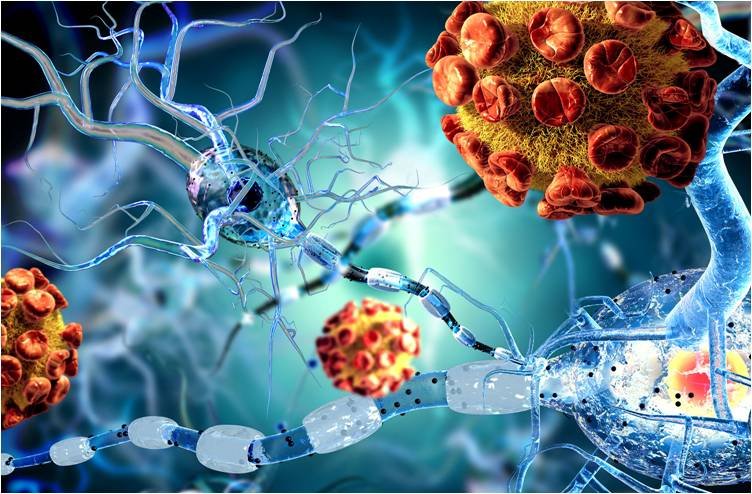 Representación microscópica de enfermedad autoinmune